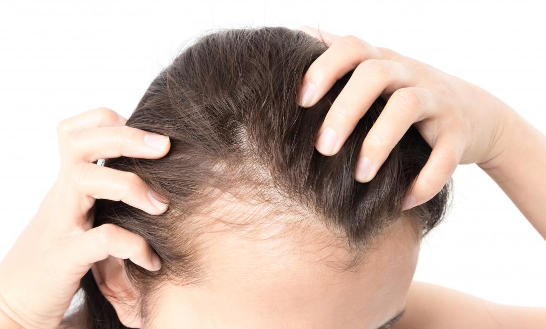 What are the Right Known Mistakes in Hair Transplant?